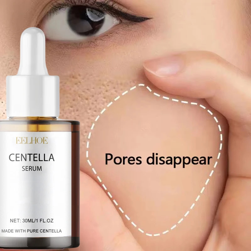 Luxury Skincare Brands - 센텔라 아시아티카 페이스 세럼 건성 피부