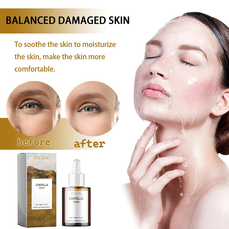 센텔라 아시아티카 페이스 세럼 건성 피부 영양 공급,  - Luxury Skincare Brands 리뷰 및 가격
